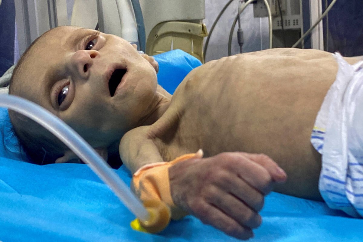 Corte de Haia ordena que Gaza tenha acesso à comida