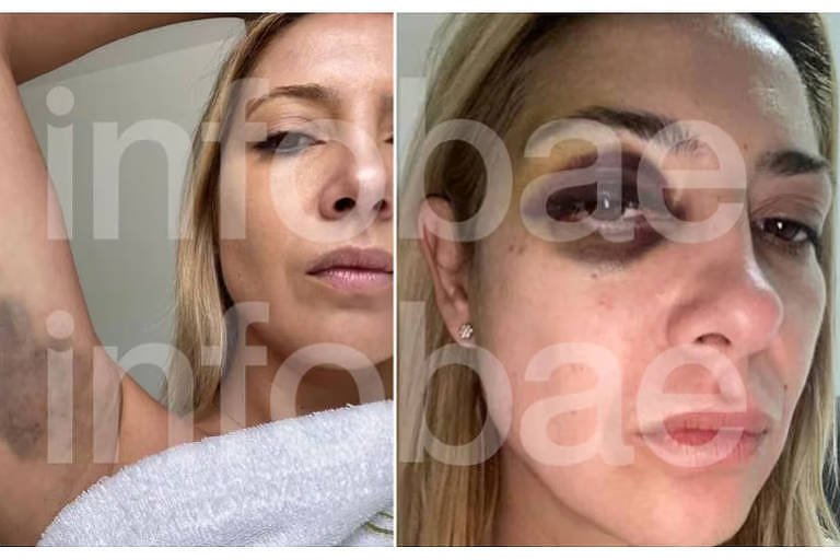 Yañez foi vítima de violência inaceitável, diz Janja - 21/08/2024