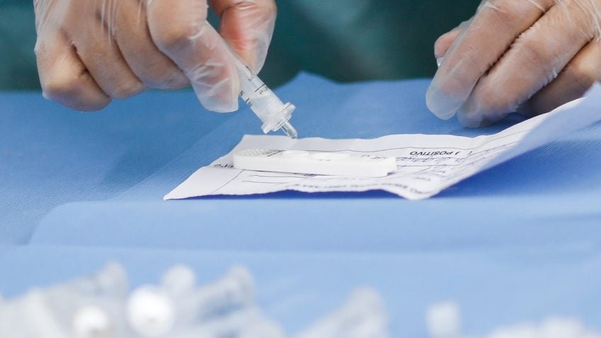 Nova variante do vírus Sars-CoV-2 é identificada em 3 Estados