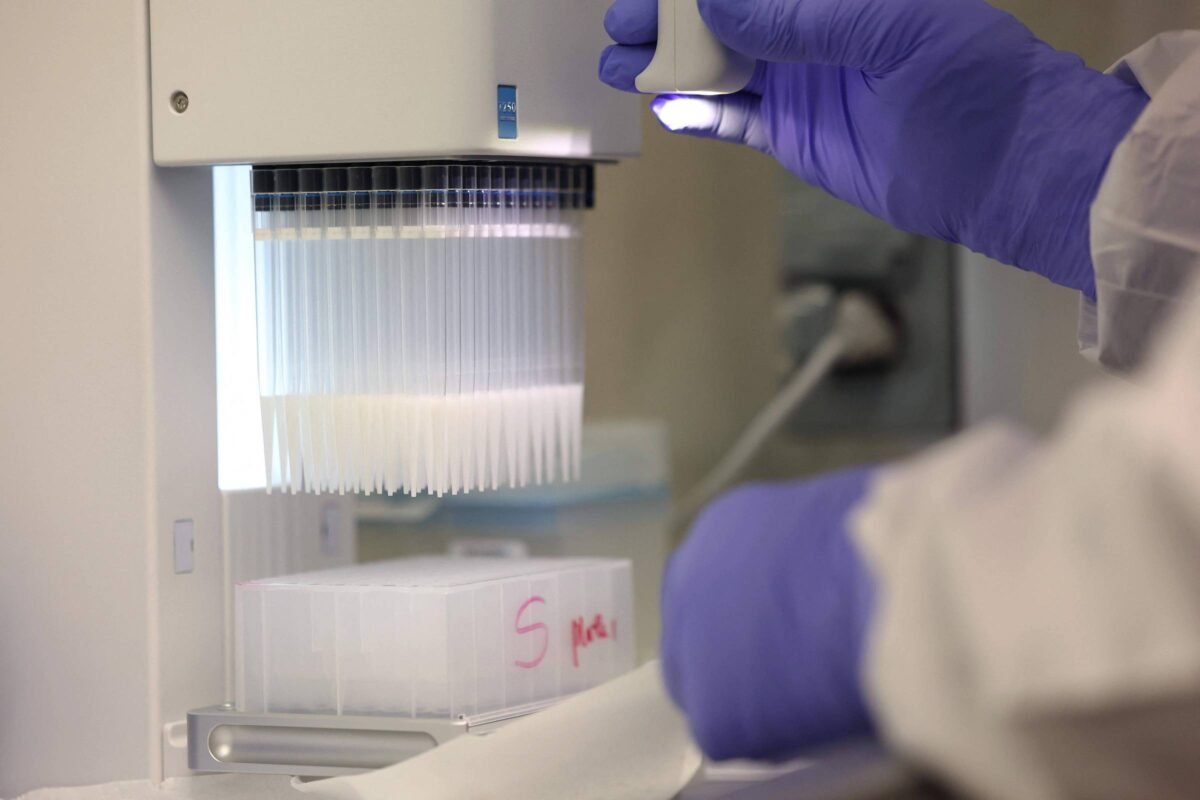 Homem morre por gripe aviária H5N5 em Washington - 22/11/2025