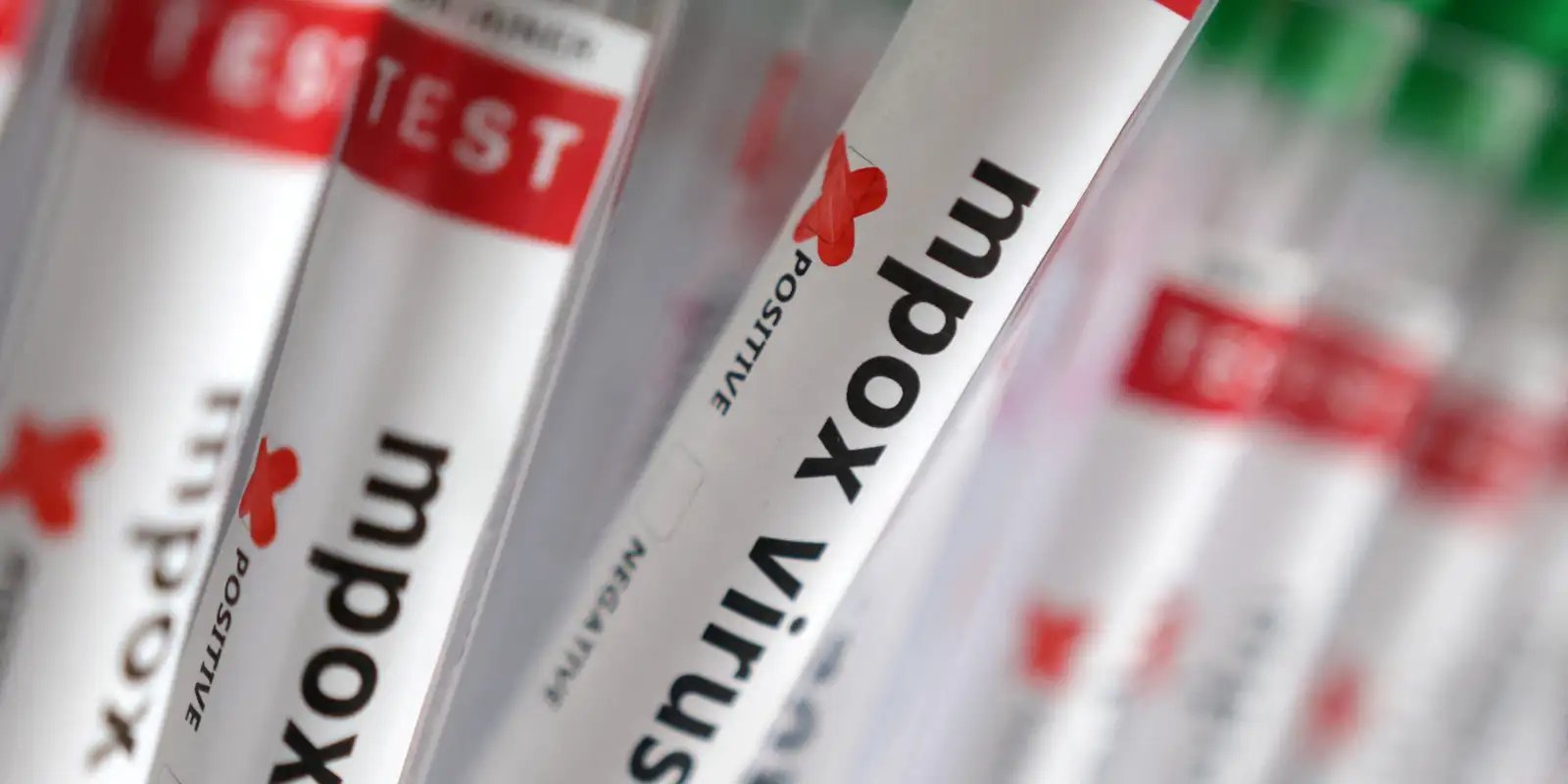 Sobe para 140 número de casos confirmados de Mpox no